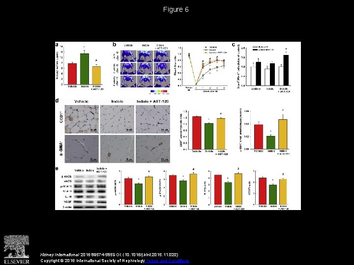 Figure 6 Kidney International 2016 89574 -585 DOI: (10. 1016/j. kint. 2015. 11. 020)