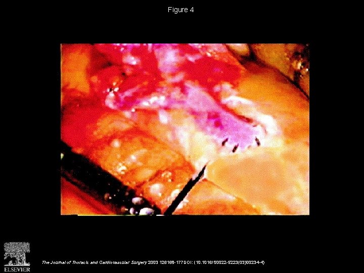 Figure 4 The Journal of Thoracic and Cardiovascular Surgery 2003 126168 -177 DOI: (10.