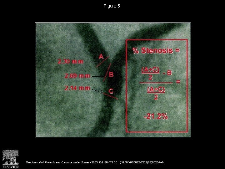 Figure 5 The Journal of Thoracic and Cardiovascular Surgery 2003 126168 -177 DOI: (10.