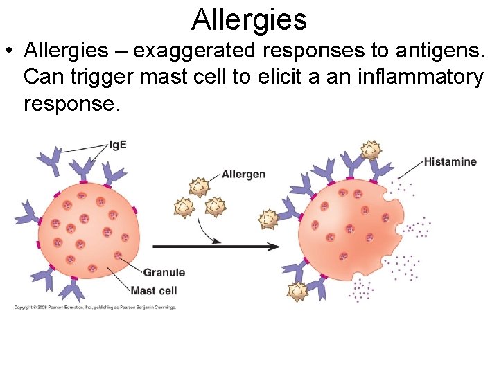 Allergies • Allergies – exaggerated responses to antigens. Can trigger mast cell to elicit