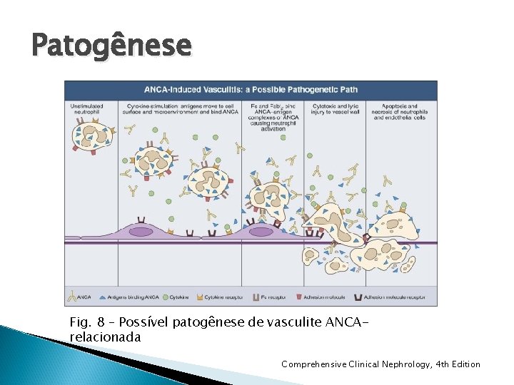 Patogênese Fig. 8 – Possível patogênese de vasculite ANCArelacionada Comprehensive Clinical Nephrology, 4 th Patogênese Fig. 8 – Possível patogênese de vasculite ANCArelacionada Comprehensive Clinical Nephrology, 4 th