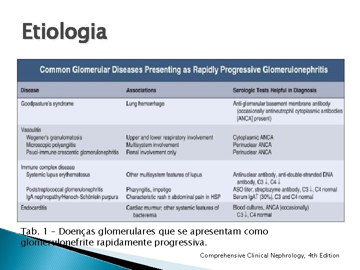Etiologia Tab. 1 – Doenças glomerulares que se apresentam como glomerulonefrite rapidamente progressiva. Comprehensive Etiologia Tab. 1 – Doenças glomerulares que se apresentam como glomerulonefrite rapidamente progressiva. Comprehensive