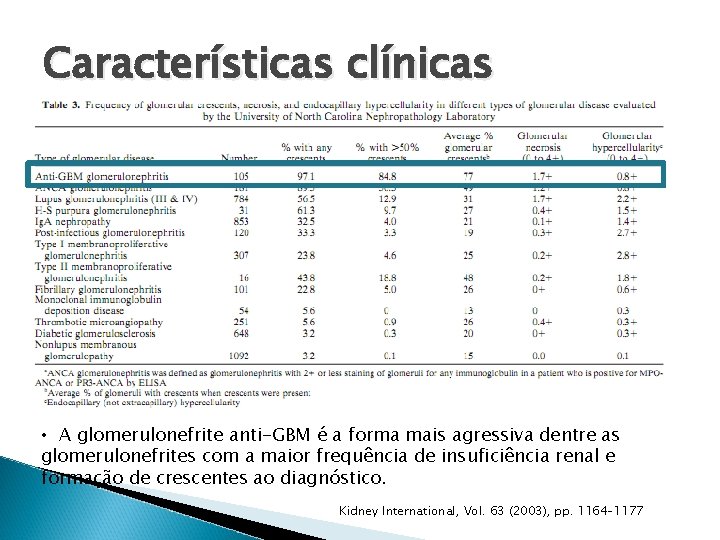 Características clínicas • A glomerulonefrite anti-GBM é a forma mais agressiva dentre as glomerulonefrites Características clínicas • A glomerulonefrite anti-GBM é a forma mais agressiva dentre as glomerulonefrites