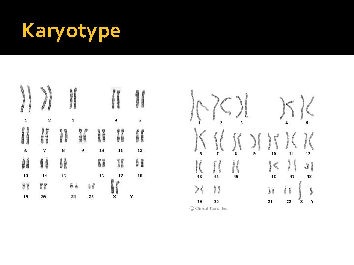 Karyotype Normal Female Normal Male 