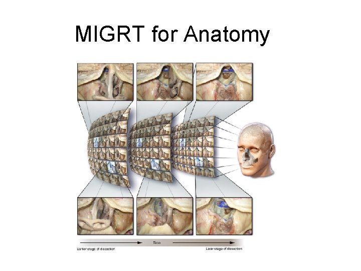 MIGRT for Anatomy 
