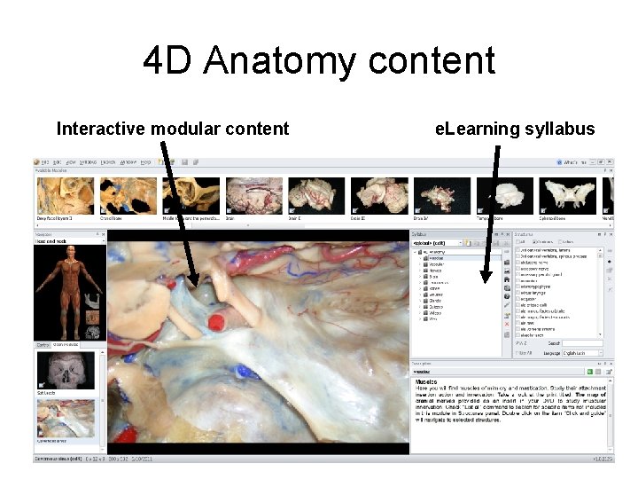 4 D Anatomy content Interactive modular content e. Learning syllabus 