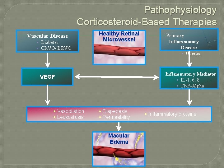 Pathophysiology Corticosteroid-Based Therapies Vascular Disease Diabetes CRVO/ BRVO Healthy Retinal Microvessel Inflammatory Mediator IL-1,