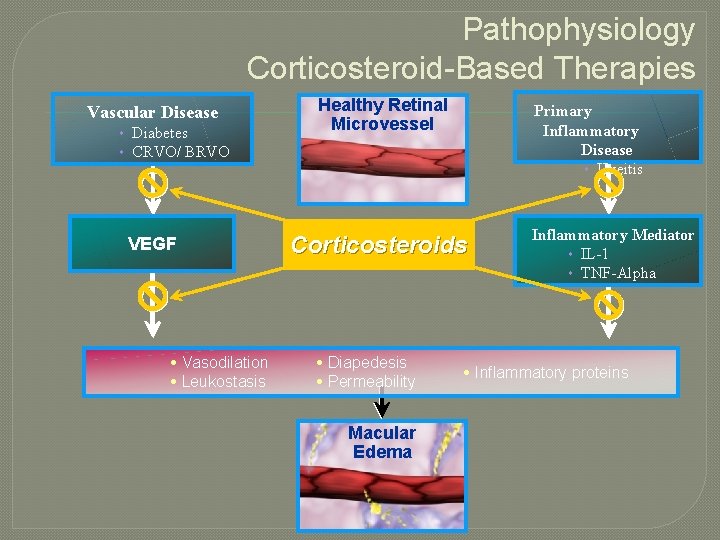 Pathophysiology Corticosteroid-Based Therapies Vascular Disease Diabetes CRVO/ BRVO VEGF Vasodilation Leukostasis Healthy Retinal Microvessel