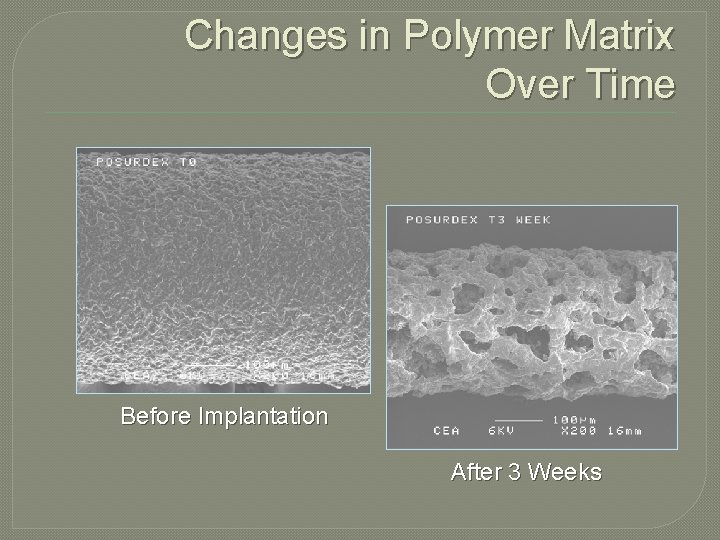 Changes in Polymer Matrix Over Time Before Implantation After 3 Weeks 