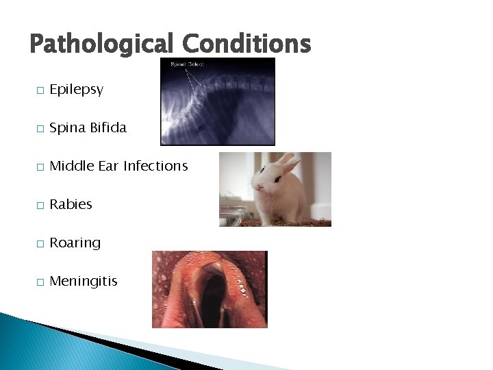 Pathological Conditions � Epilepsy � Spina Bifida � Middle Ear Infections � Rabies �