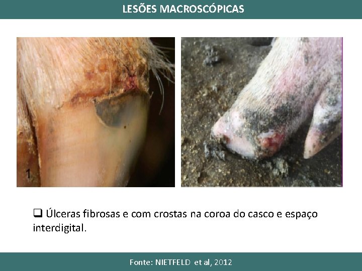 LESÕES MACROSCÓPICAS q Úlceras fibrosas e com crostas na coroa do casco e espaço