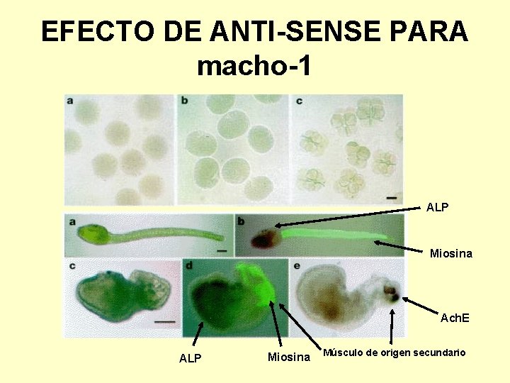 EFECTO DE ANTI-SENSE PARA macho-1 ALP Miosina Ach. E ALP Miosina Músculo de origen