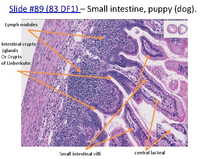 Slide #89 (83 DF 1) – Small intestine, puppy (dog). Lymph nodules Intestinal crypts