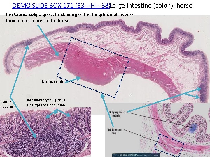 DEMO SLIDE BOX 171 (E 3‐‐‐H‐‐‐ 38). Large intestine (colon), horse. the taenia coli;