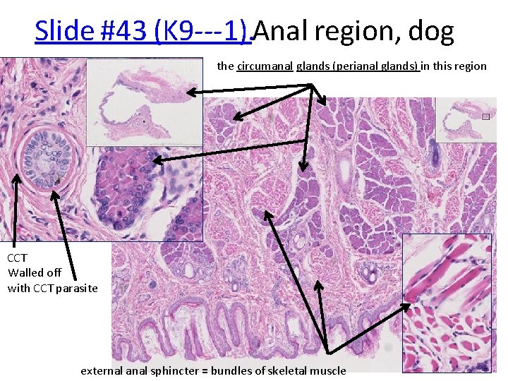 Slide #43 (K 9‐‐‐ 1). Anal region, dog the circumanal glands (perianal glands) in