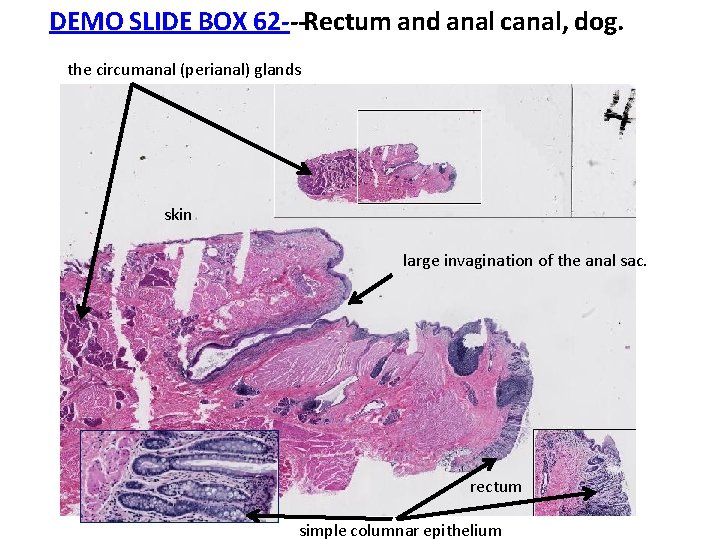DEMO SLIDE BOX 62‐‐‐Rectum and anal canal, dog. the circumanal (perianal) glands skin large