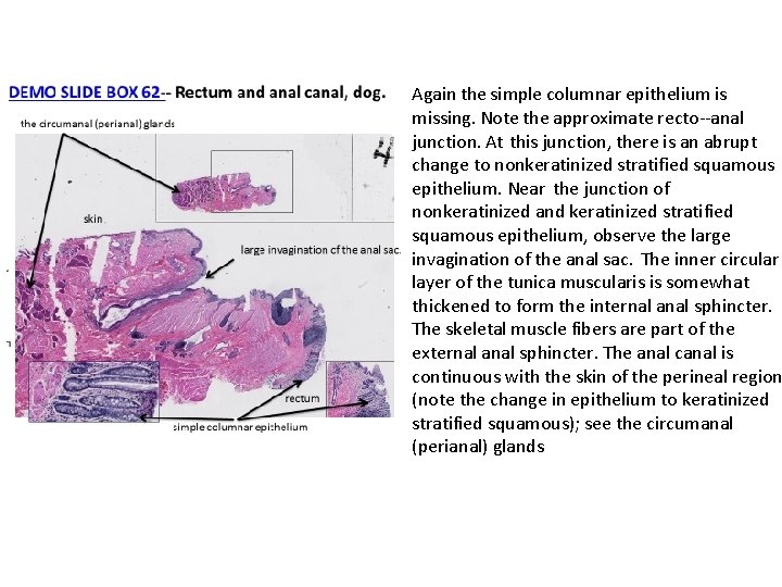 Again the simple columnar epithelium is missing. Note the approximate recto‐‐‐anal junction. At this