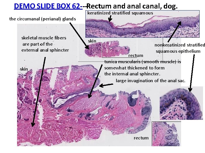 DEMO SLIDE BOX 62‐‐‐Rectum and anal canal, dog. the circumanal (perianal) glands skeletal muscle