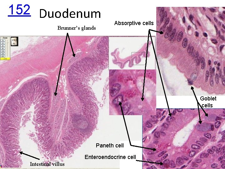 152 Duodenum Brunner’s glands Absorptive cells Goblet cells Paneth cell Enteroendocrine cell Intestinal villus