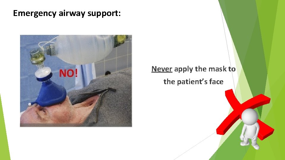 Emergency airway support: Never apply the mask to the patient’s face 