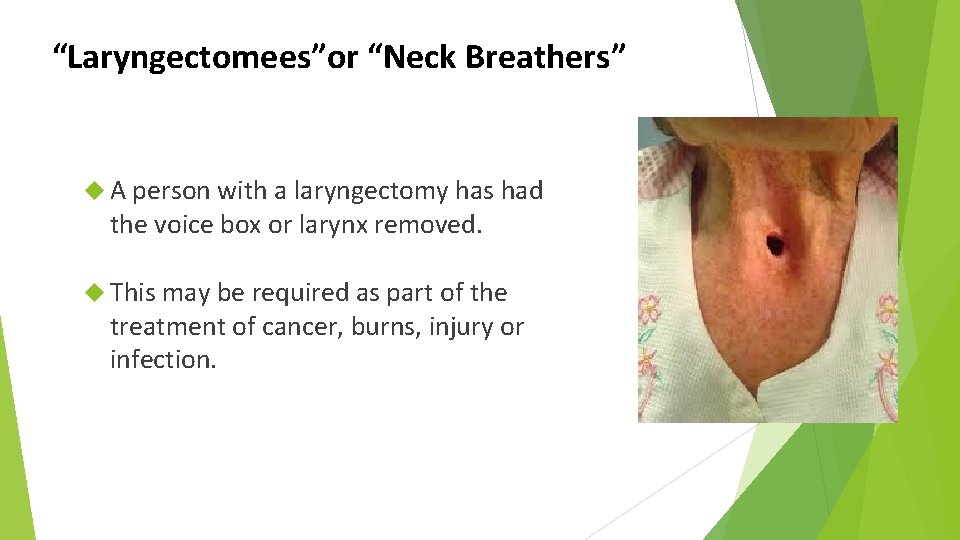 “Laryngectomees”or “Neck Breathers” A person with a laryngectomy has had the voice box or