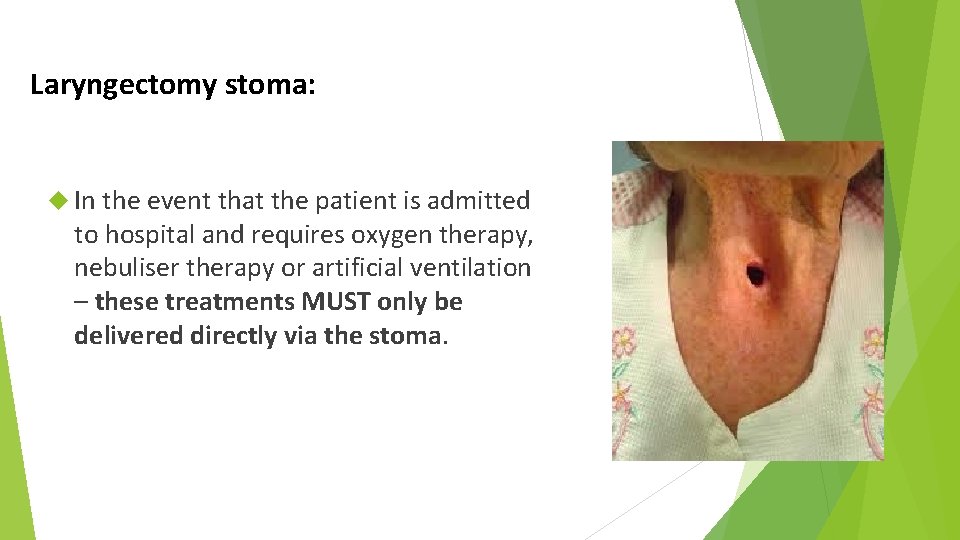 Laryngectomy stoma: In the event that the patient is admitted to hospital and requires