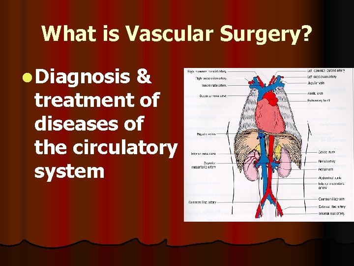 What is Vascular Surgery? l Diagnosis & treatment of diseases of the circulatory system