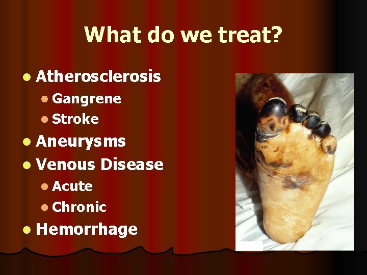 What do we treat? l Atherosclerosis l Gangrene l Stroke l Aneurysms l Venous