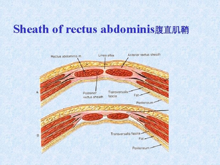 Sheath of rectus abdominis腹直肌鞘 Sheath of rectus abdominis腹直肌鞘