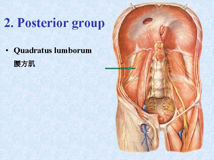 2. Posterior group • Quadratus lumborum 腰方肌 2. Posterior group • Quadratus lumborum 腰方肌