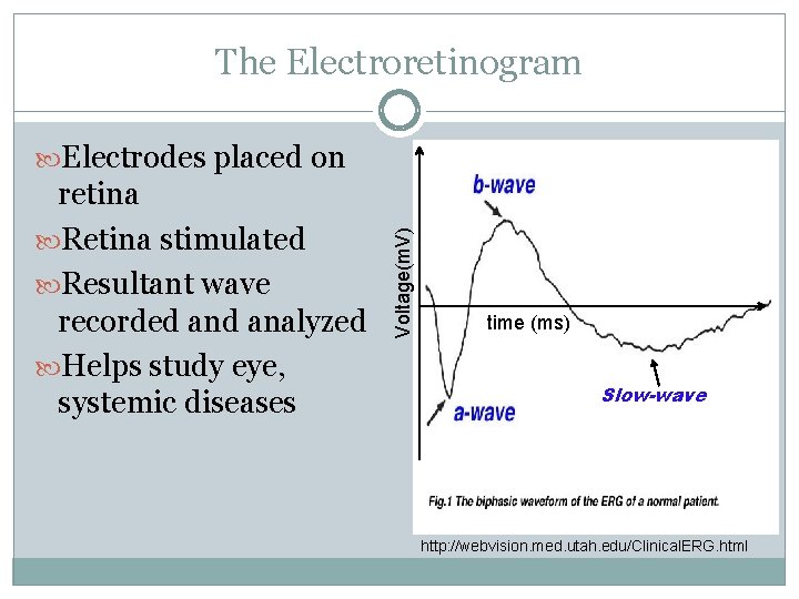 The Electroretinogram retina Retina stimulated Resultant wave recorded analyzed Helps study eye, systemic diseases