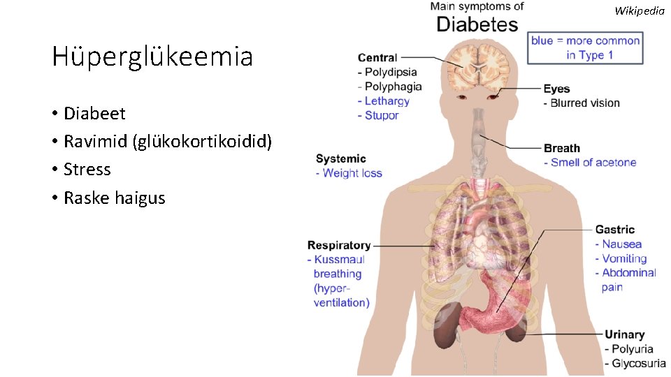 Wikipedia Hüperglükeemia • Diabeet • Ravimid (glükokortikoidid) • Stress • Raske haigus 