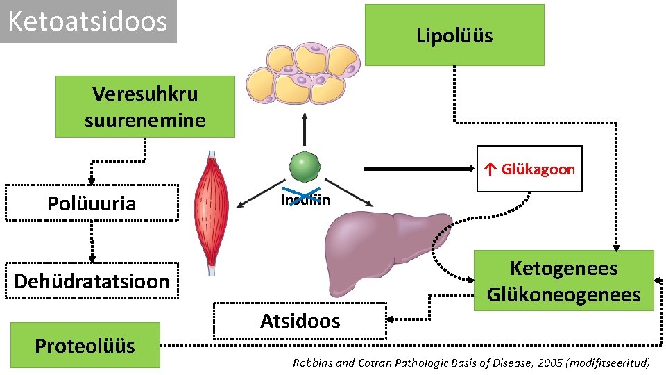 Ketoatsidoos Lipolüüs Veresuhkru suurenemine ↑ Glükagoon Polüuuria Insuliin Dehüdratatsioon Proteolüüs Atsidoos Ketogenees Glükoneogenees Robbins