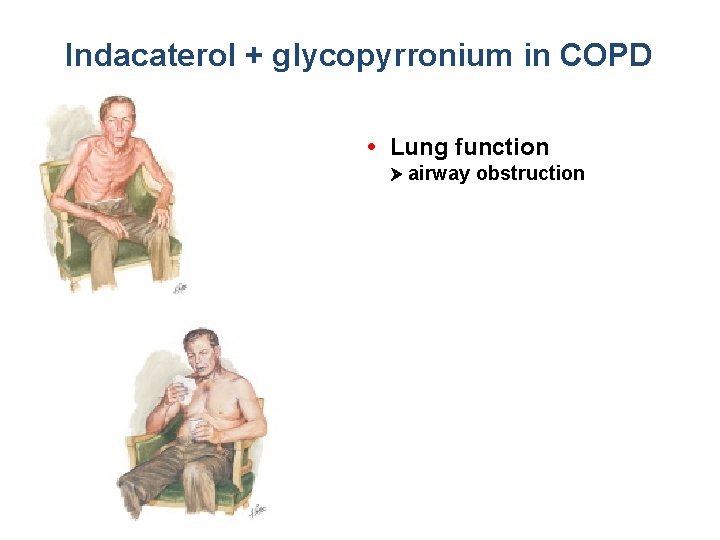 Indacaterol + glycopyrronium in COPD • Lung function airway obstruction 