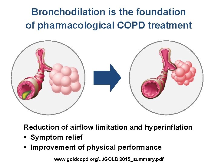 Bronchodilation is the foundation of pharmacological COPD treatment Reduction of airflow limitation and hyperinflation