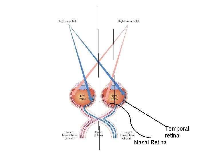 Temporal retina Nasal Retina 