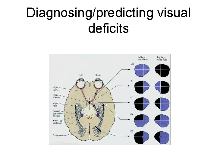Diagnosing/predicting visual deficits 