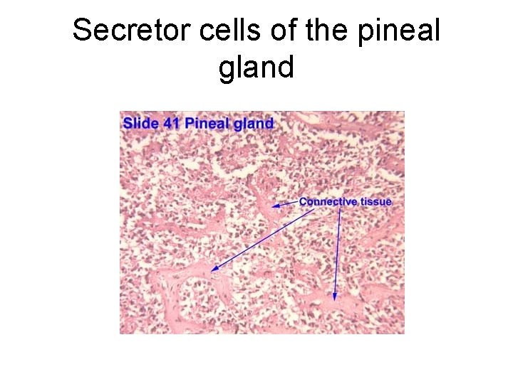 Secretor cells of the pineal gland 