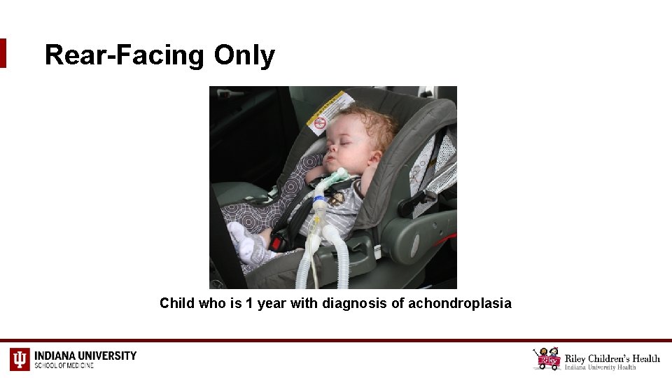 Rear-Facing Only Child who is 1 year with diagnosis of achondroplasia 