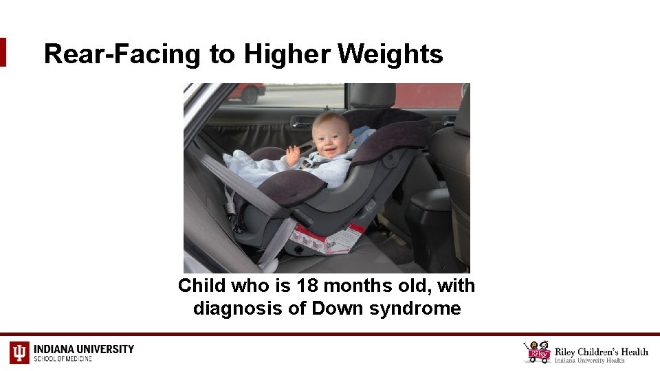 Rear-Facing to Higher Weights Child who is 18 months old, with diagnosis of Down