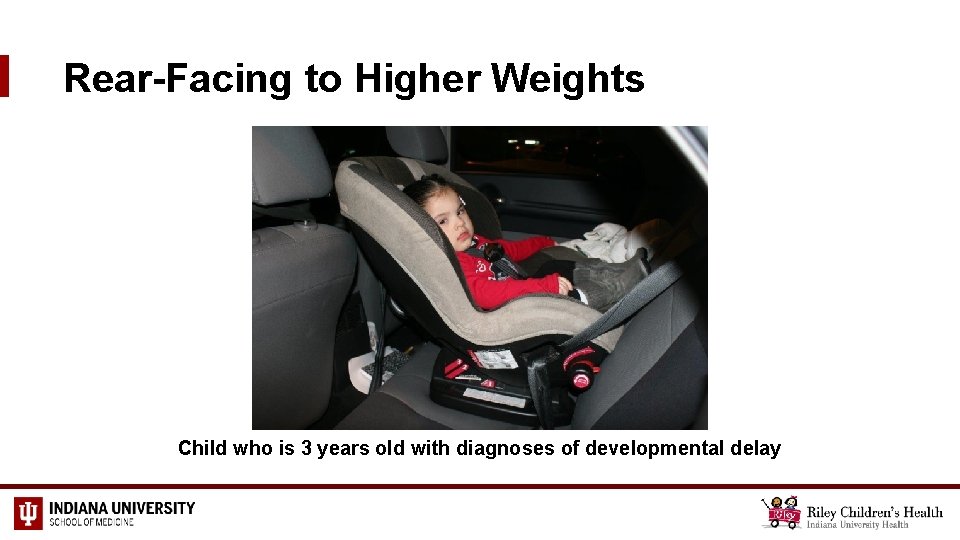 Rear-Facing to Higher Weights Child who is 3 years old with diagnoses of developmental
