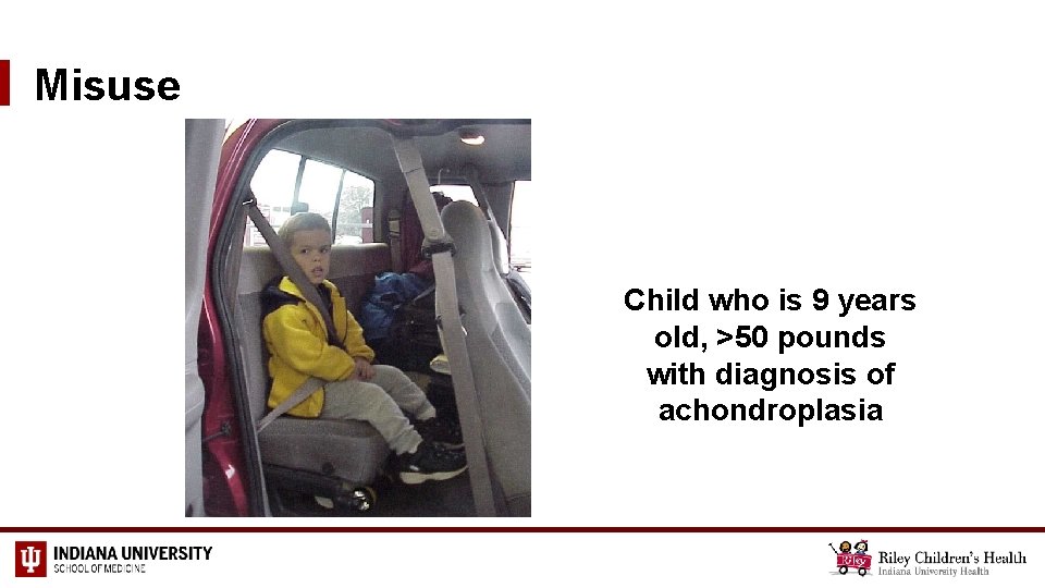 Misuse Child who is 9 years old, >50 pounds with diagnosis of achondroplasia 