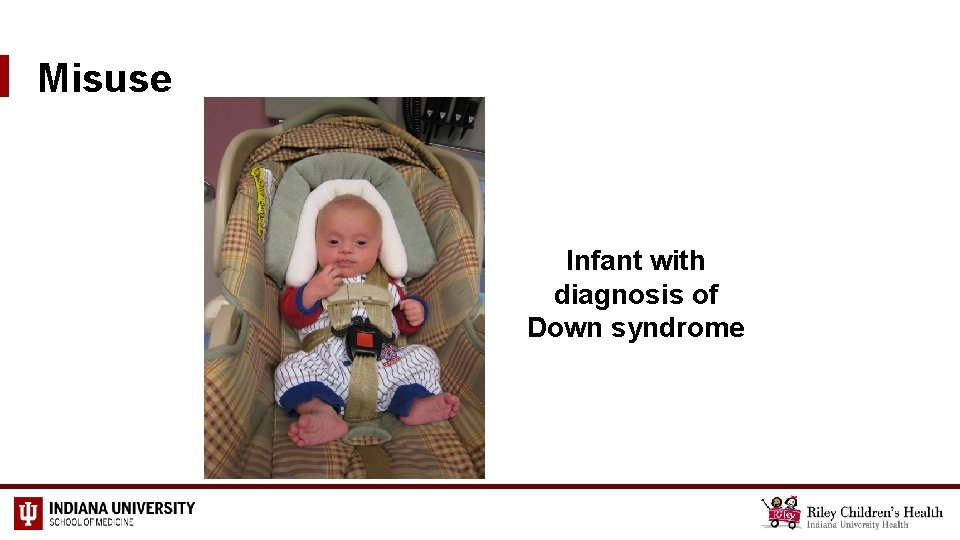 Misuse Infant with diagnosis of Down syndrome 