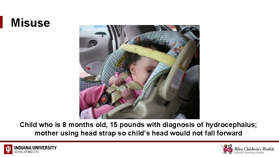 Misuse Child who is 8 months old, 15 pounds with diagnosis of hydrocephalus; mother