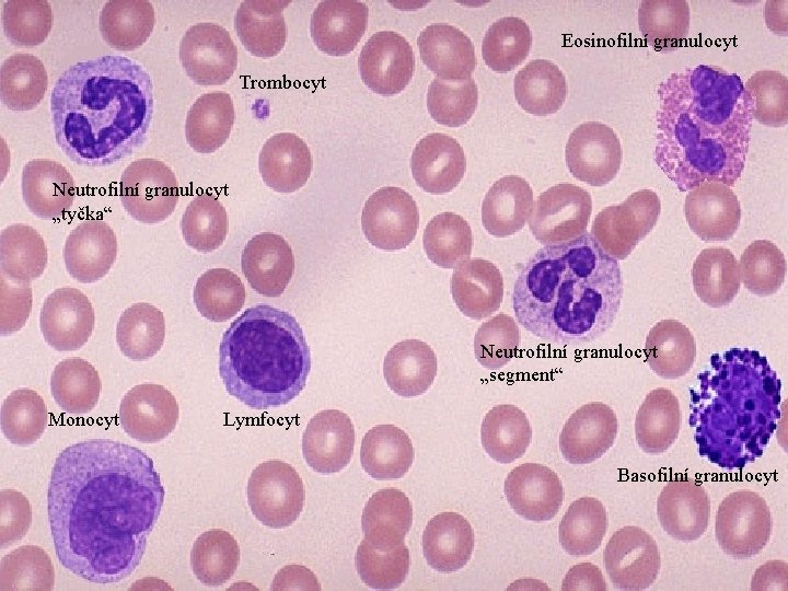 Eosinofilní granulocyt Trombocyt Neutrofilní granulocyt „tyčka“ Neutrofilní granulocyt „segment“ Monocyt Lymfocyt Basofilní granulocyt 