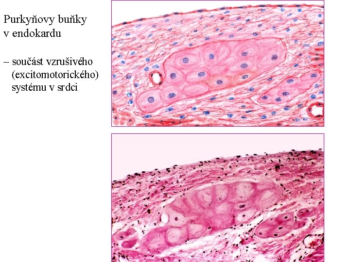 Purkyňovy buňky v endokardu – součást vzrušivého (excitomotorického) systému v srdci 