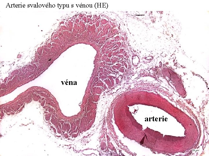 Arterie svalového typu s vénou (HE) véna arterie 
