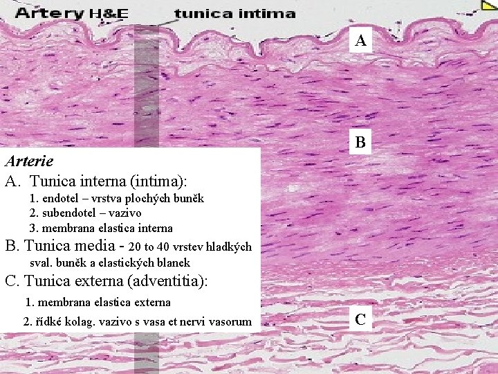 A B Arterie A. Tunica interna (intima): 1. endotel – vrstva plochých buněk 2.