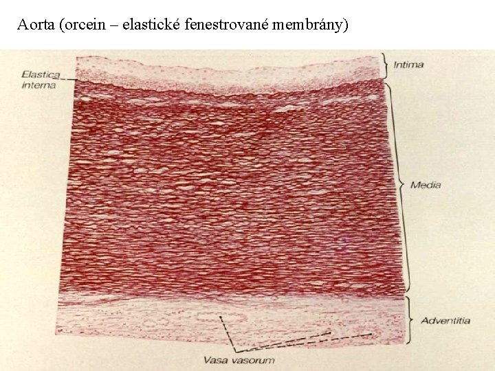 Aorta (orcein – elastické fenestrované membrány) 