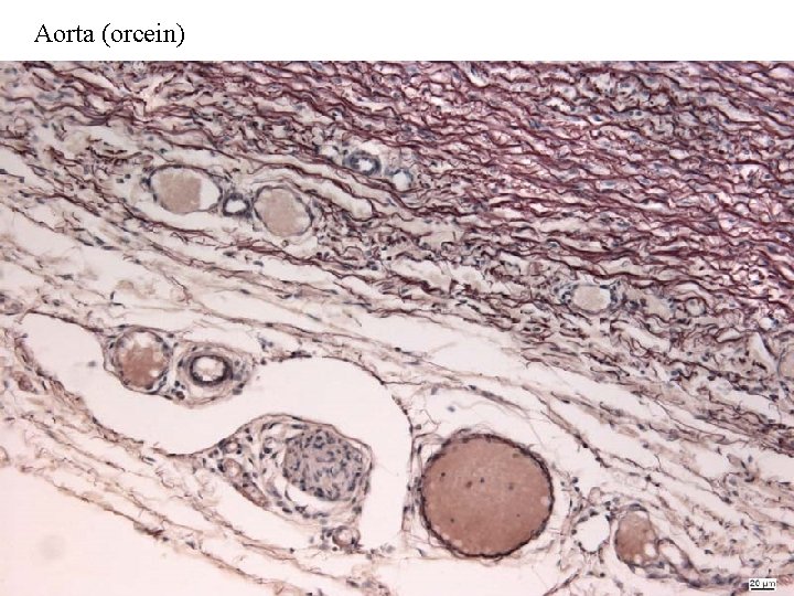 Aorta (orcein) 